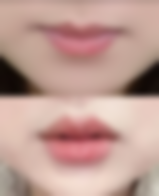 五、沈阳孟强医疗美容诊所实例