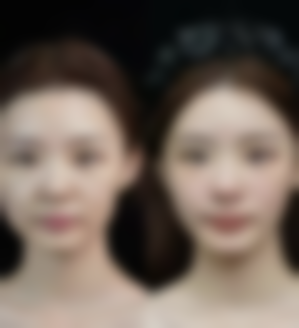 四、水木皮肤科开展的主要项目和特色项目：