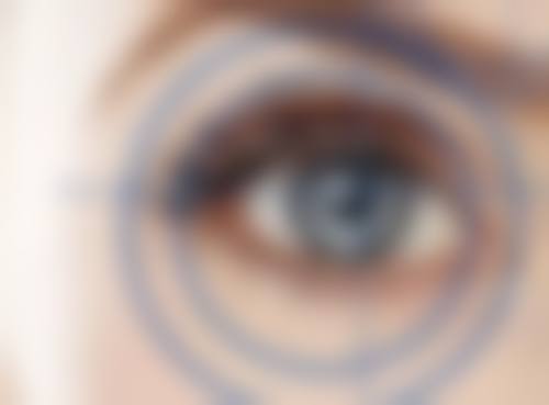 五、广州盛芝雅整形医院实例