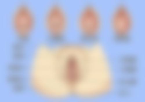 开双眼皮暗藏哪些风险？眼部功能问题及应对策略揭秘