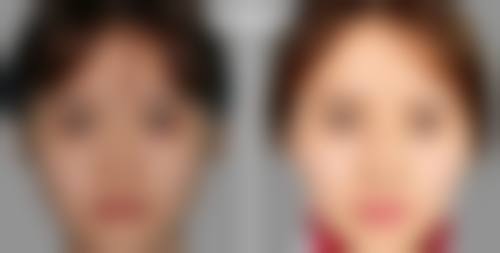 四、西安韩佳人整形医疗美容医院实例