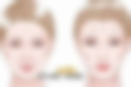 假体隆胸取出手术是否住院？住院时长参考