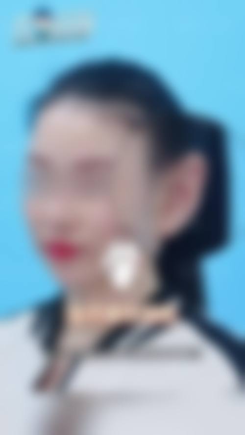 五、深圳慈佑世纪夫人整形医院实例