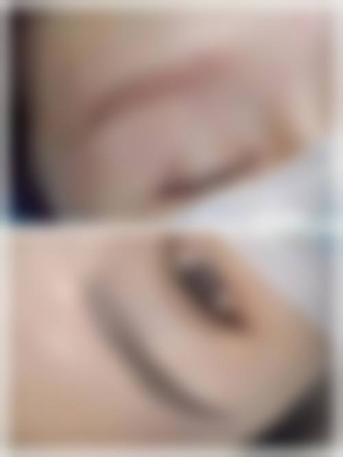 六、莆田新生植发医疗美容门诊部价格表：（仅供参考）