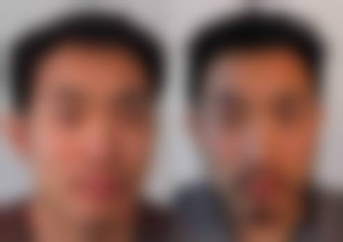 八、清远雍禾植发医院真实的顾客评价如下：