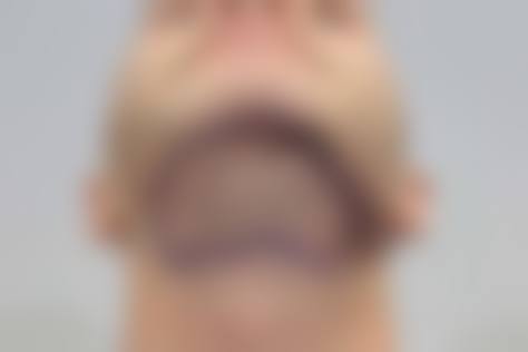 五、清远雍禾植发医院实例