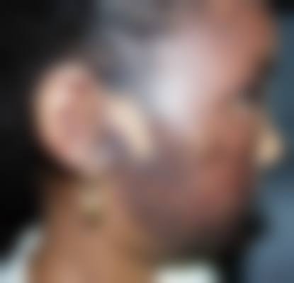 汪锦伦医生怎么样可靠吗？