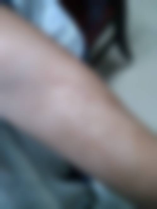 汪锦伦医生口碑和评价