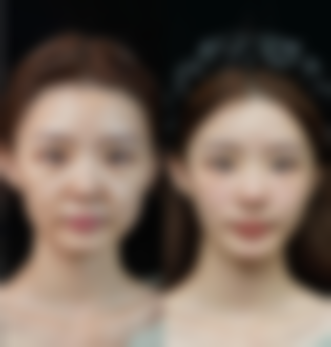 五、西安韩佳人整形医疗美容医院怎么预约：