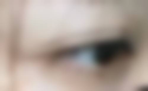 常用的烧伤疤痕治疗方法