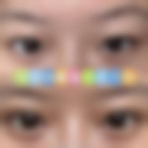 八、河南省煤炭总医院激光整形中 心真实的顾客评价如下：