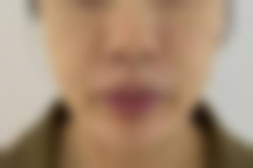 八、美自人整形外科真实的顾客评价如下：