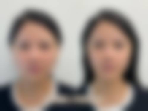 五、大连悦美格医疗美容实例