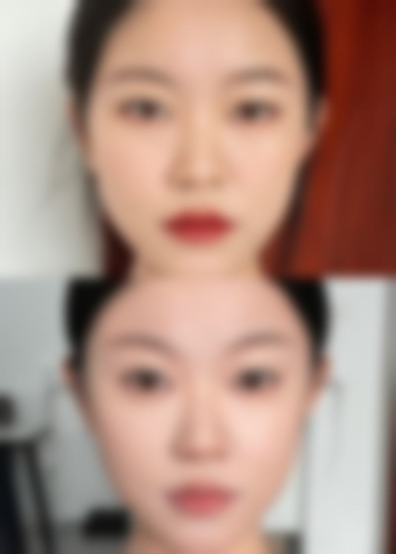 宝俪隆胸假体究竟好不好？高等级凝胶+多样型号+长保效期，优势尽显！ 