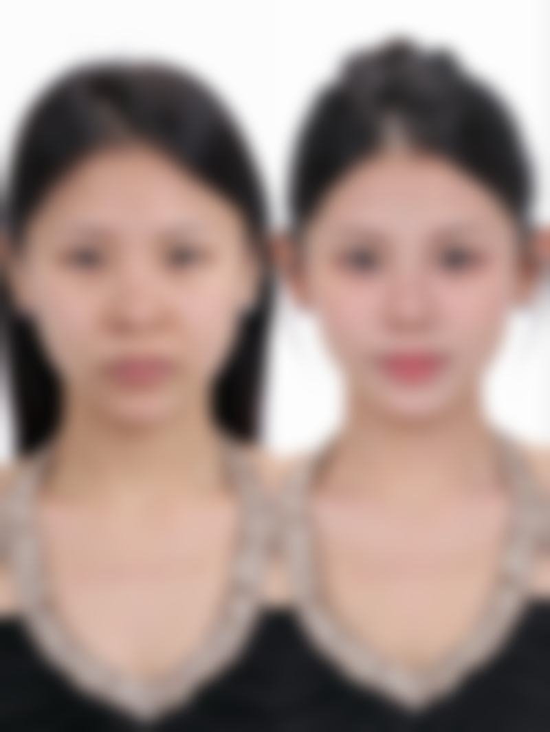 五、美自人整形外科实例