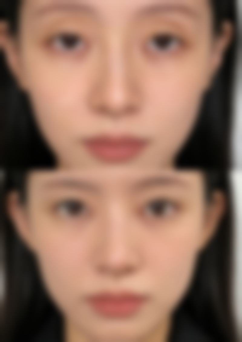 四、东莞贝佳整形医院实例