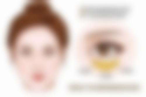 美妍高科去眼袋：四重成效显著，副作用难有空间