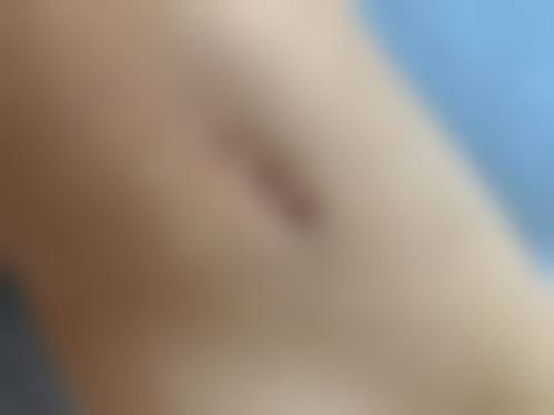 八、北京火箭军总医院激光整形美容中 心（原二炮）真实的顾客评价如下：