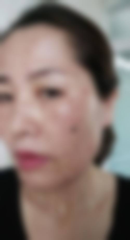 五、韩国Rejuel Clinic丽珠尔皮肤科江南店怎么预约：