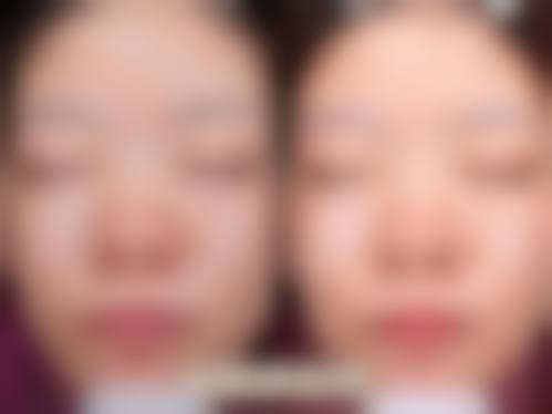 四、韩国Rejuel Clinic丽珠尔皮肤科江南店实例