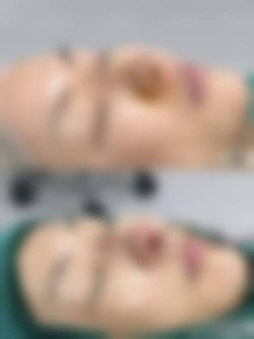 六、韩国Rejuel Clinic丽珠尔皮肤科江南店价格表：（仅供参考）