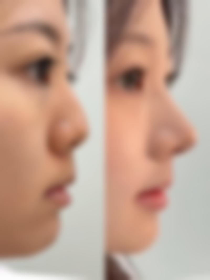 安殷模医生在哪家医院怎么预约？