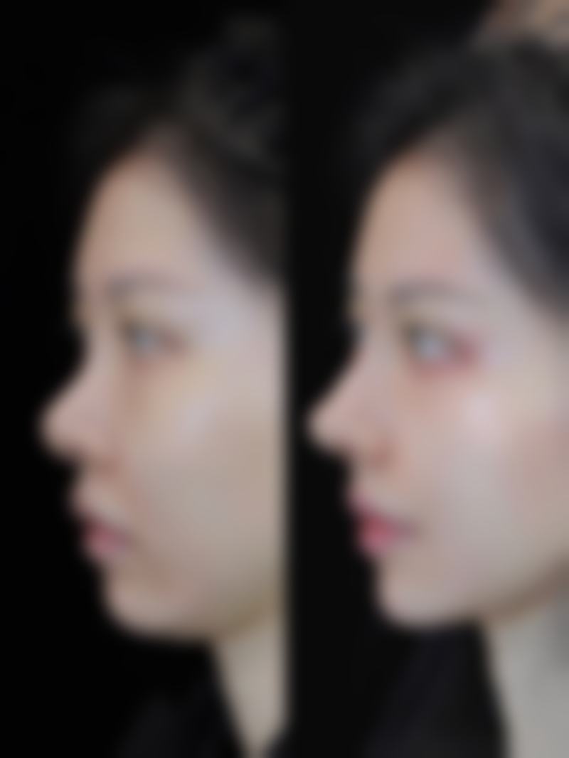 五、珠海亿至纤整形医院实例