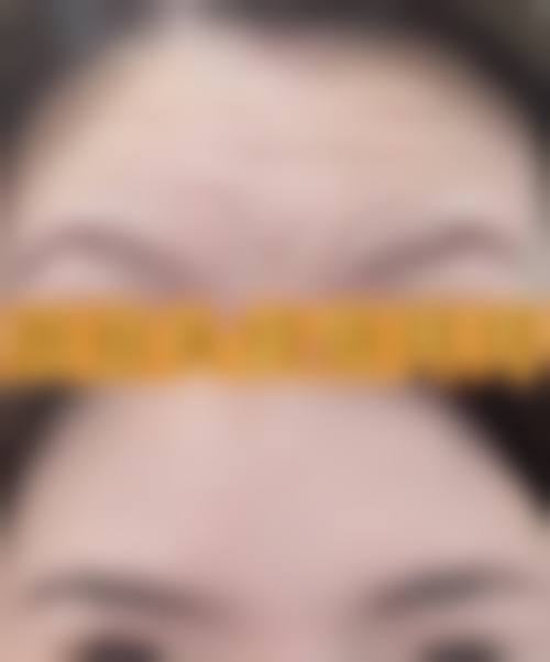 七、深圳秀尔医疗美容价格表：（仅供参考）