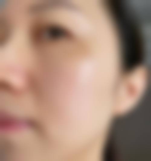 六、贵港东晖医院皮肤美容科怎么预约：