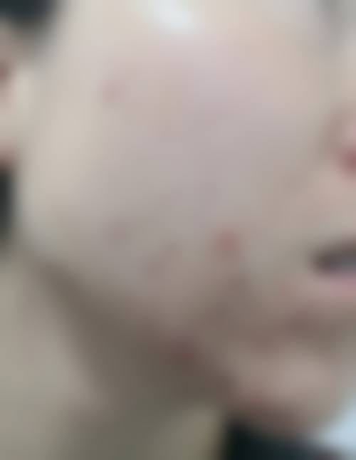 七、贵港东晖医院皮肤美容科价格表：（仅供参考）