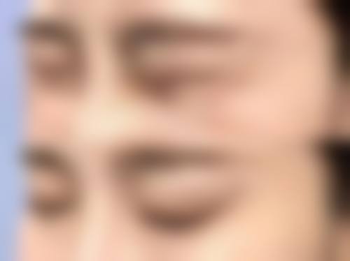 五、深圳秀尔医疗美容实例