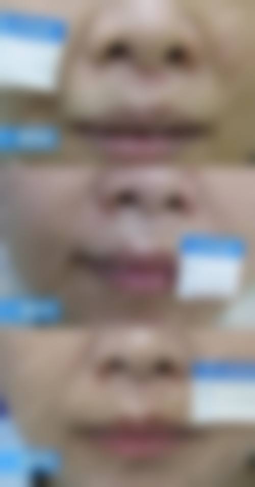 梁志刚医生实例