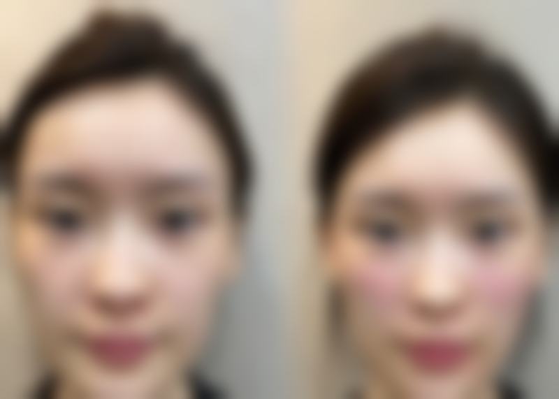 六、太原精灵医疗美容门诊怎么预约：