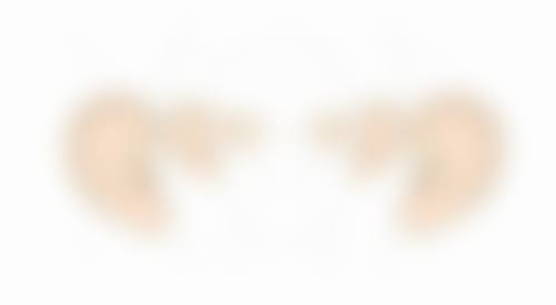 怎样有效去除下眼袋下眼纹？生活护理结合医美手段，多管齐下重塑眼周年轻态 