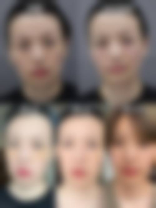 八、郑州金水正美医疗美容门诊部真实的顾客评价如下：