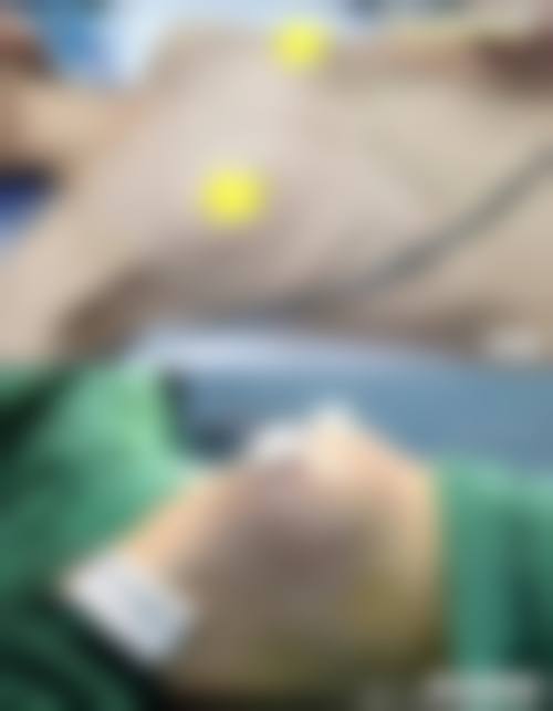 五、北京玥美医疗美容门诊实例