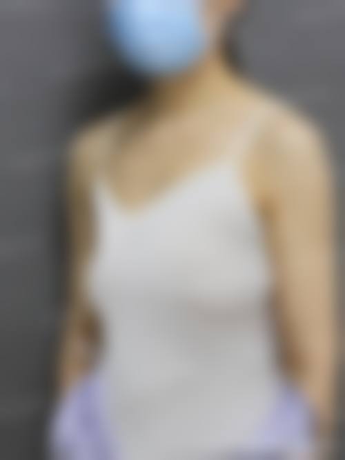 五、南宁南国妇产医院整形科实例