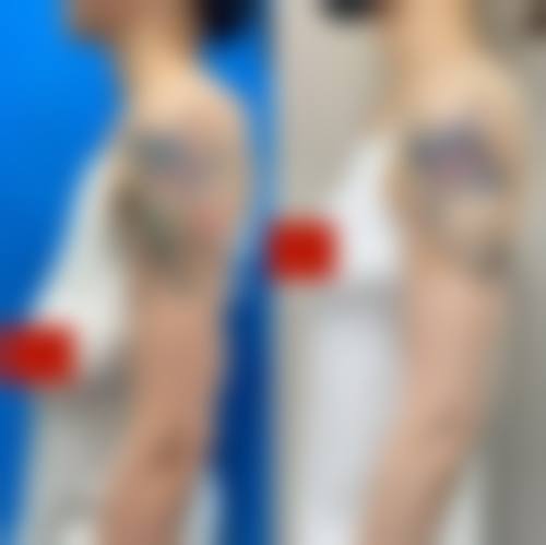 六、南京美飒整形医院怎么预约：