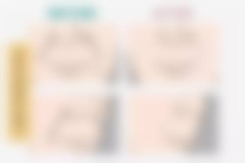 总结：多种方法结合，效率高修复烫伤疤痕