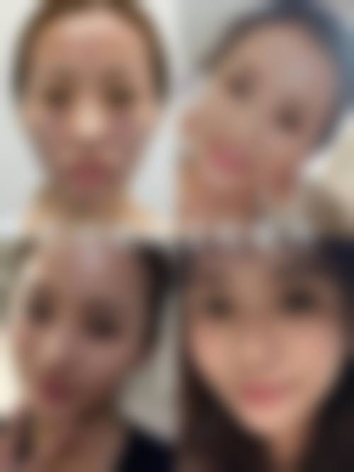 五、上海仁泉整形医院怎么预约：