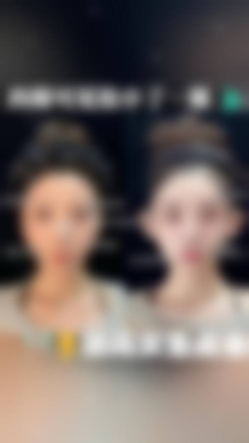 二、黄石美亚整形医疗美容门诊部正规吗？来看看医院资质：