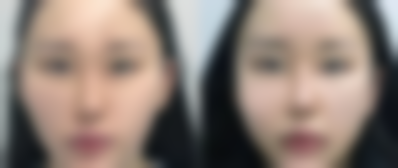 五、重庆永合美整形医院怎么预约：