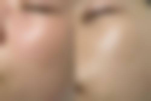 八、韩国Clean N 皮肤科医院真实的顾客评价如下：