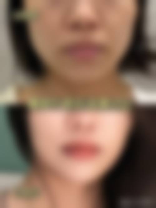 周俞医生怎么样可靠吗？