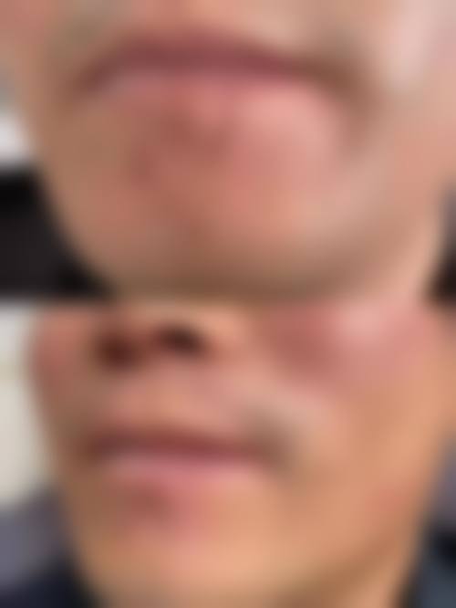 七、韩国Clean N 皮肤科医院价格表：（仅供参考）
