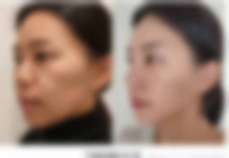 八、廊坊凯润婷医疗美容门诊部真实的顾客评价如下：
