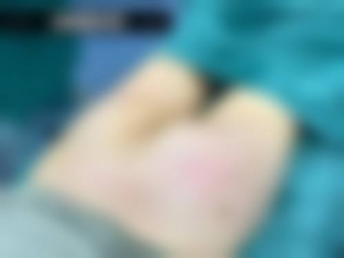 六、成都御美汇整形医院怎么预约：