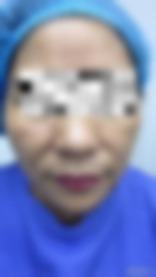 五、南京维格整形医院实例