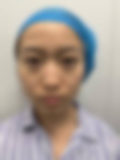 八、峨眉山兴亿医学美容诊所真实的顾客评价如下：