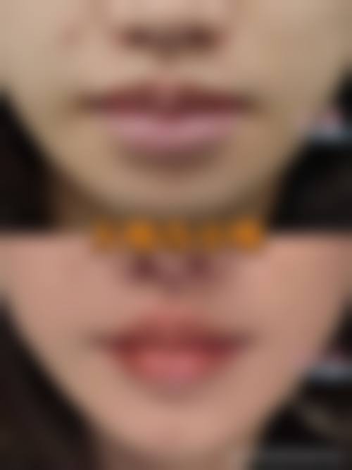 六、成都利美康爵丽医疗美容门诊部怎么预约：